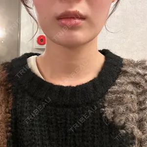 BiBiクリニック口コミ