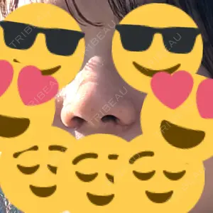 銀座マイアミ美容外科口コミ