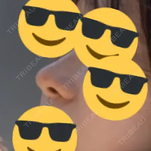 銀座マイアミ美容外科口コミ