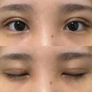 オーキッド美容クリニック東京御徒町口コミ