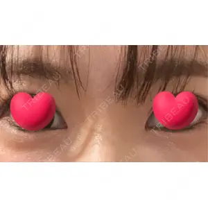HAAB×DREAM BEAUTY CLINIC HAAB BEAUTY CLINIC 名古屋院口コミ