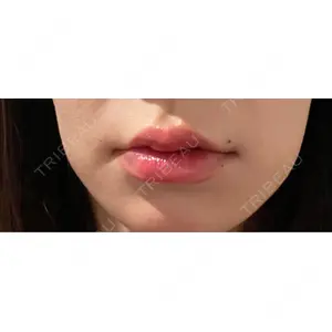 HAAB×DREAM BEAUTY CLINIC HAAB BEAUTY CLINIC 名古屋院口コミ