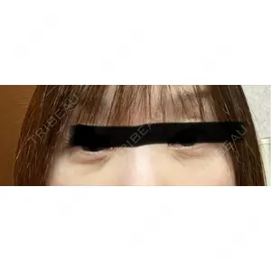 HAAB×DREAM BEAUTY CLINIC HAAB×DREAM BEAUTY CLINIC 東京本院口コミ