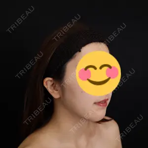 藤・ナチュレ美容クリニック 藤・ナチュレ美容クリニック 銀座院口コミ