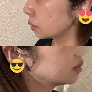 口コミ