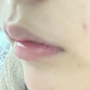口コミ