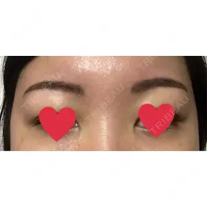 APスキンクリニック銀座口コミ