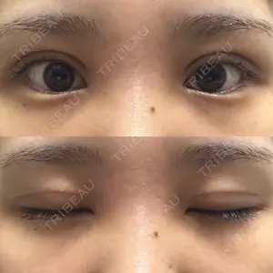オーキッド美容クリニック東京御徒町口コミ