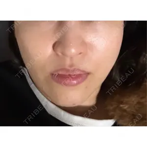 APスキンクリニック銀座の