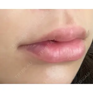 HAAB×DREAM BEAUTY CLINIC HAAB BEAUTY CLINIC 名古屋院口コミ