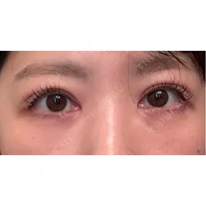 東京シンデレラ美容外科 東京シンデレラ美容外科 池袋院口コミ