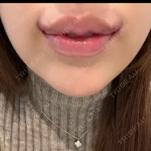 R Beauty CLINIC R Beauty CLINIC 銀座院口コミ