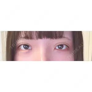 湘南美容クリニック 湘南美容クリニック 池袋東口院口コミ