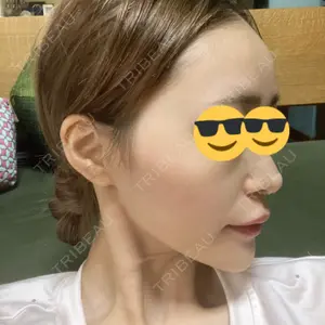 YBC横浜美容外科 YBC横浜美容外科 大宮院口コミ