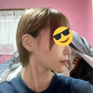 YBC横浜美容外科 YBC横浜美容外科 大宮院口コミ