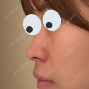 口コミ