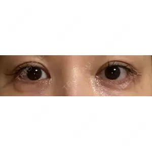 口コミ