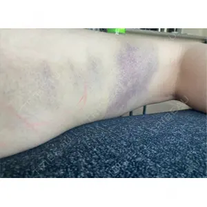 銀座マイアミ美容外科口コミ