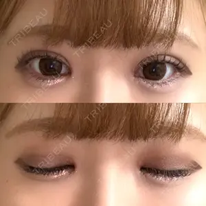 東京シンデレラ美容外科 東京シンデレラ美容外科 池袋院口コミ