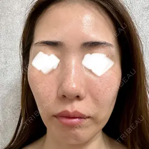 ミニマムスキンクリニック ミニマムスキンクリニック池袋口コミ