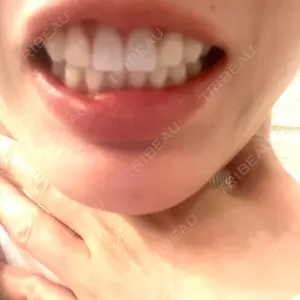 目黒まついデンタルクリニック口コミ