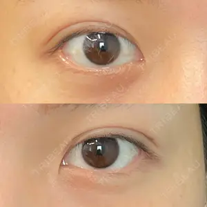 湘南美容クリニック 湘南美容クリニック 千葉センシティ院口コミ