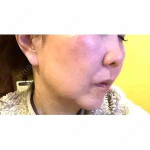 ルラ美容クリニック ルラ美容クリニック 名古屋栄院 / ルラスキンクリニック 名古屋栄院口コミ