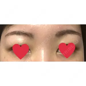 APスキンクリニック銀座口コミ