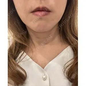 PTクリニック六本木口コミ
