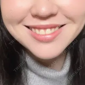 口コミ