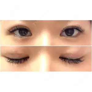 東京イセアクリニック口コミ