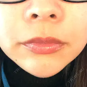 REAL BEAUTY CLINIC REAL BEAUTY CLINIC 新宿東口院口コミ