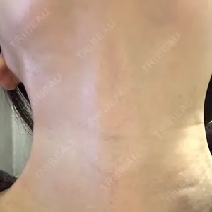 APスキンクリニック銀座の
