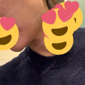 TCB東京中央美容外科 TCB東京中央美容外科 町田院口コミ