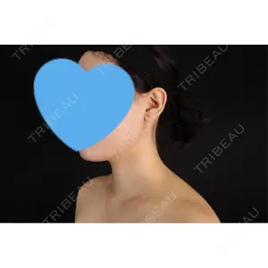 藤・ナチュレ美容クリニック 藤・ナチュレ美容クリニック 銀座院口コミ