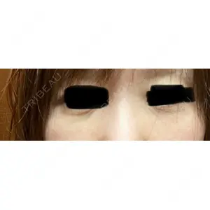 HAAB×DREAM BEAUTY CLINIC HAAB×DREAM BEAUTY CLINIC 東京本院口コミ