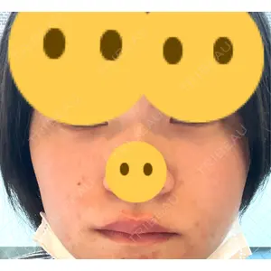 HAAB×DREAM BEAUTY CLINIC HAAB×DREAM BEAUTY CLINIC 東京本院口コミ