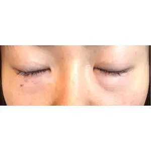 ミニマムスキンクリニック ミニマムスキンクリニック池袋口コミ