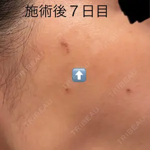 AURORA CLINIC（オーロラクリニック）新宿院口コミ