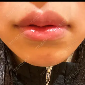 R Beauty CLINIC R Beauty CLINIC 銀座院口コミ