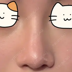 ユニーク美容外科口コミ