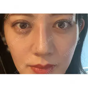 口コミ
