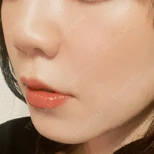 L‘amour clinic Tokyo【ラムールクリニック東京】口コミ