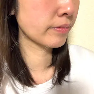 口コミ