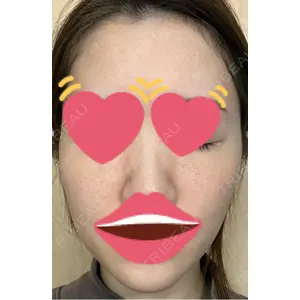 LIFIX BEAUTY CLINIC口コミ