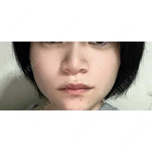 HAAB×DREAM BEAUTY CLINIC HAAB×DREAM BEAUTY CLINIC 東京本院口コミ