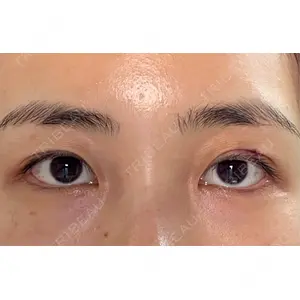 オアシス美容外科口コミ