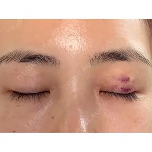 オアシス美容外科口コミ