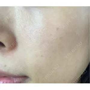 ミニマムスキンクリニック ミニマムスキンクリニック池袋口コミ