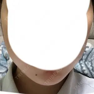 DMTC美容皮膚科 DMTC美容皮膚科 渋谷院口コミ